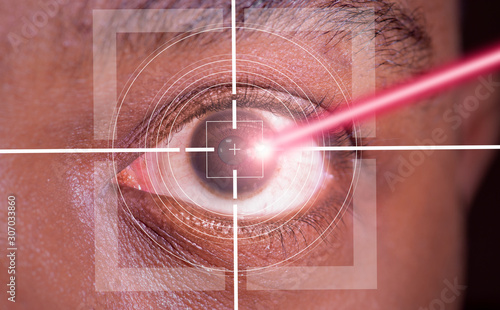 laser or lasik eye surgery concept, l laser beam shining into african america male dark brown eyes photo
