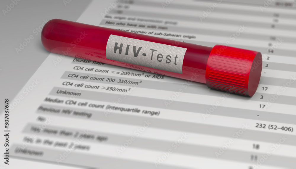 Test of the HIV virus, blood tube. Analysis to find out if you are infected with the virus. AIDS. The human immunodeficiency viruses, 3d render Test of the HIV virus, blood tube. Analysis to find out if you are infected with the virus. AIDS. The human immunodeficiency viruses, 3d render