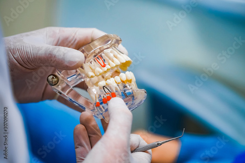 Doctor shows on a plastic jaw sample or model different methods of teeth treatment. Modern dental clinic background. Health concept. White medical gloves on male doctor's hands.