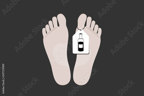 Dead deceased body after death. Alcoholic and habitual drinker died because of alcoholism and substance abuse. Vector illustration. 