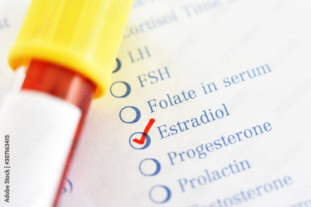 Fotka „Blood sample tube with laboratory requisition form for estradiol