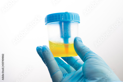 Photos Urine analysis in the laboratory