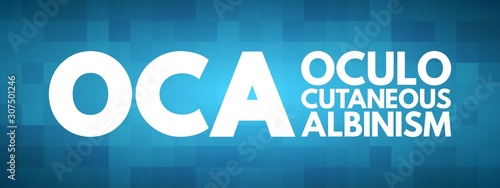 OCA - Oculo Cutaneous Albinism acronym, concept background