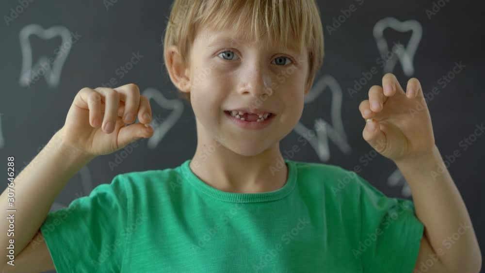 Little boy shows that some of his milk teeth had fallen out. Concept of