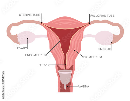Menstrual cup - feminine hygiene product, device for collecting blood during menstruation and period is used inside the vagina of woman female