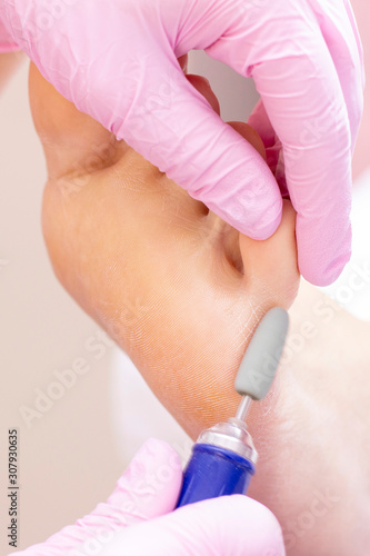 Young woman getting professional pedicure in a beauty salon, closeup. Professional beauty salon. Pedicure, manicure concept. cracked and corns on the feet. vertical photo