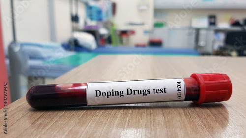 Laboratory sample of blood for doping drugs test. Doping is the used of banned athletic performance enhancing drug by athlete in competitive sport. Medical test in sport medicine concept. photo