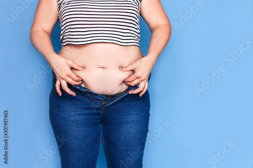 Fat woman in jeans showing her excess weight.