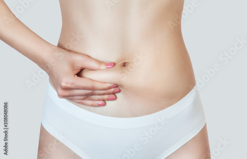 A woman shows body fat on her stomach. Overweight treatment and athletic lifestyle. Cosmetology concept.