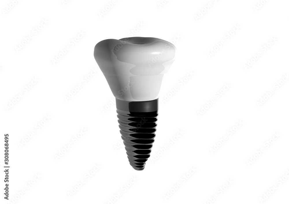 Dental implantation, prosthetics, tooth on a white background 3d illustration Dental implantation, prosthetics, tooth on a white background 3d illustration