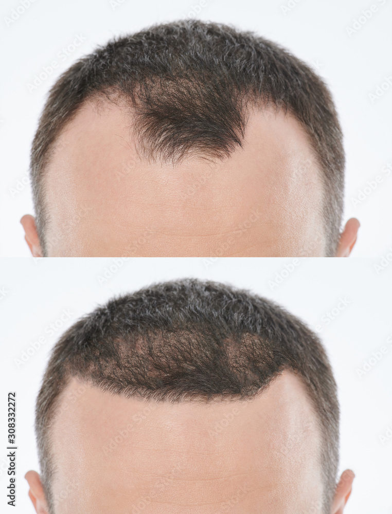 Fototapeta premium Bold problem treatment