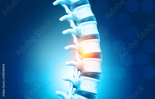 Quadro su tela Human spine, vertebrae anatomy on science background