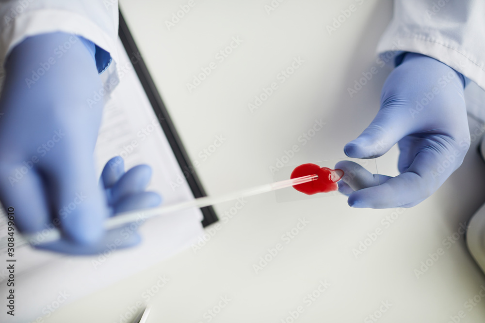 Close-up of doctor in protective gloves holding pipette and analyzing blood samples at the table Close-up of doctor in protective gloves holding pipette and analyzing blood samples at the table