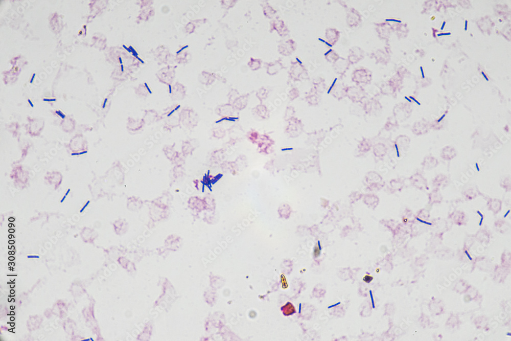 Gram positive bacilli (Bacteria , Microscopic cell, Medical technologist)