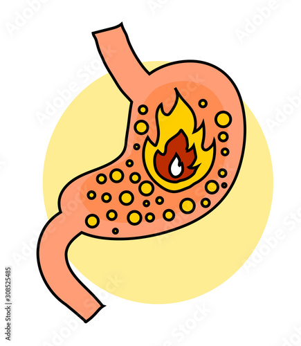 Stomach on a white background. Heartburn. An object. Vector illustration.