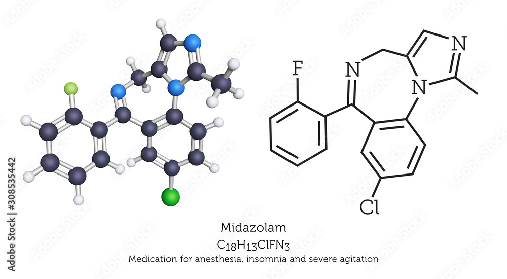 Midazolam is used to treat anesthesia, sleeplessness, anxiety and severe agitation. 