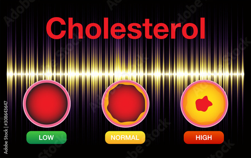 Cholesterol in artery, health risk , vector design