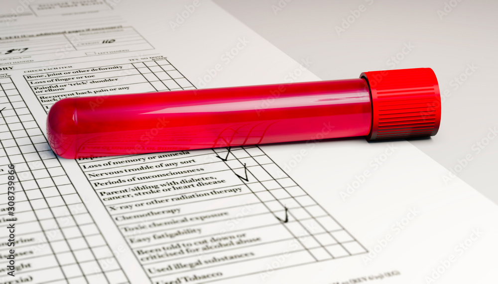 Blood collection and analysis, test tube with blood. Viruses and diseases, HIV, AIDS, 3d render Blood collection and analysis, test tube with blood. Viruses and diseases, HIV, AIDS, 3d render