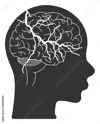 Brain carcinoma vector icon. Flat Brain carcinoma pictogram is isolated on a white background.
