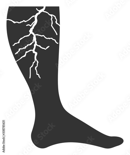 Deep vein thrombosis vector icon. Flat Deep vein thrombosis pictogram is isolated on a white background.