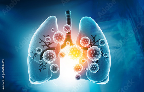 Viral lung infections, lung infection conept. 3d illustration.