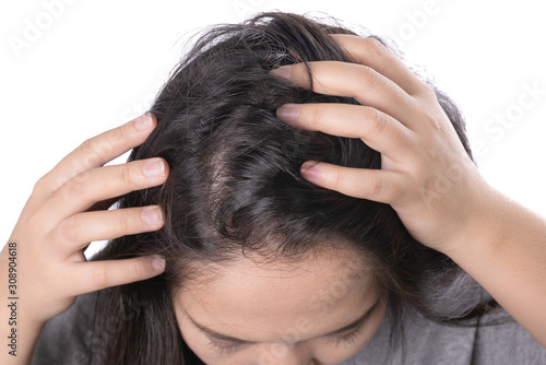 Pretty Asian women itching,scratch about problem hair loss,head bald,lice,dandruff.hair loss problem and Hair treatment concept