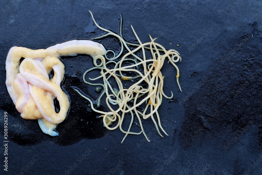 Invertebrate Zoology and Hybrobiology,Threadworm,Nematodes on a black ...