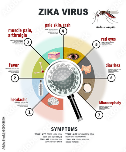 Zika virus infographic elements - prevention, transmission, vaccine, symptoms, microcephaly, protection measures. Zika virus disease. Zika virus design template. Isolated vector illustration.