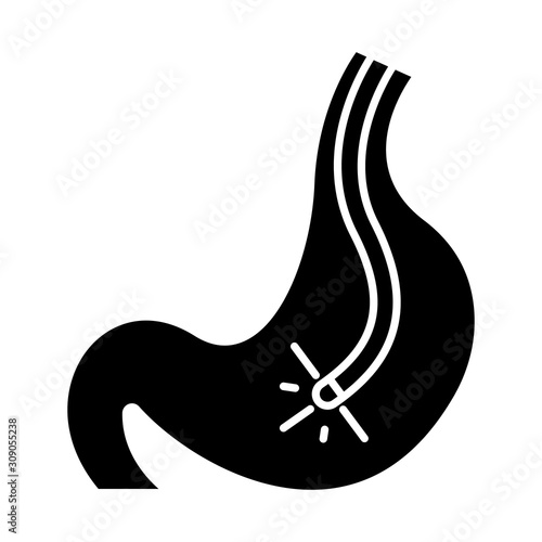 Endoscopy glyph icon. Gastroscopy process. Medical nonsurgical procedure. Healthcare services. Disease diagnostics. Visual inspection. Silhouette symbol. Negative space. Vector isolated illustration