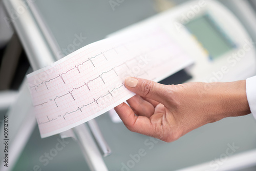 Close up of doctors hand with electrocardigram result photo