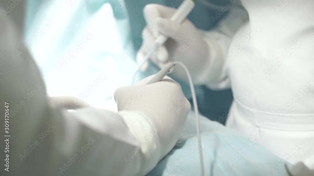 Close-up of surgeon's hands during operation dolly Close-up of surgeon's hands during operation dolly