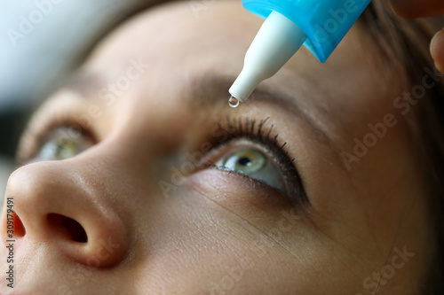 Female putting liquid drops in her eye solving vision problem