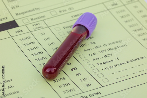 Blood in test tubes and investigation form.