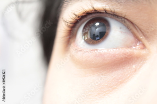 Brown eye with dilated pupil