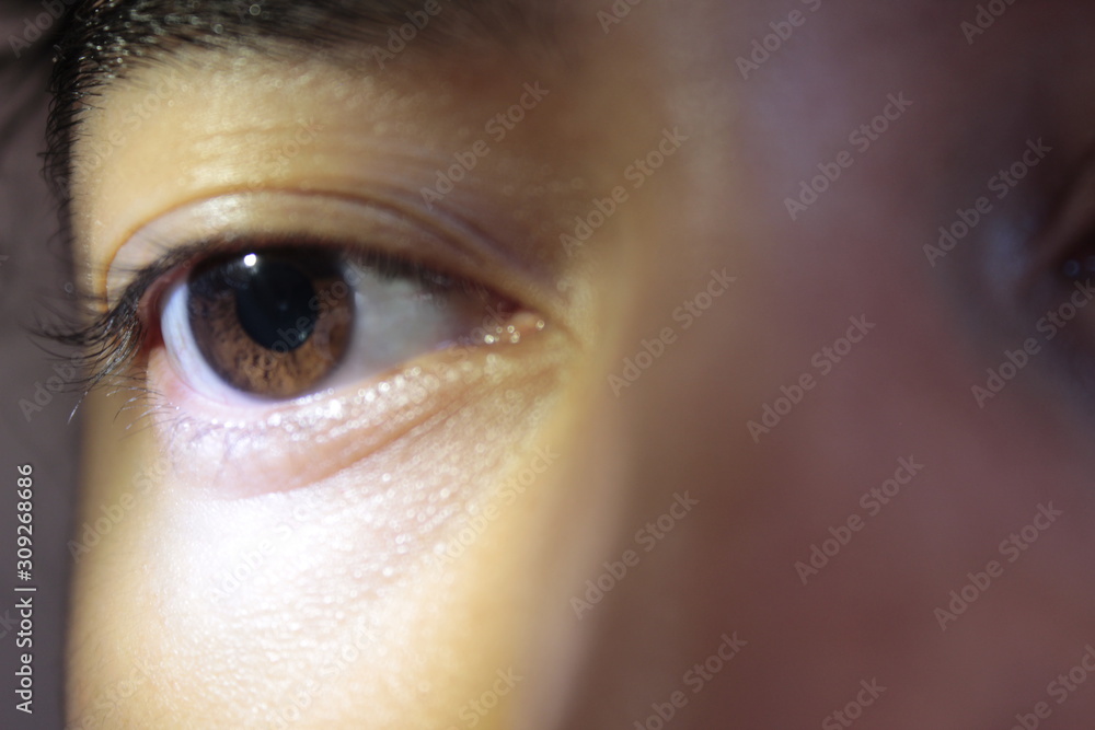 Dilated pupil close up Dilated pupil close up