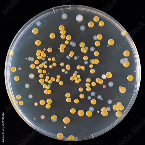 Fényképezés Agar culture of various bacteria on agar in a Petri dish