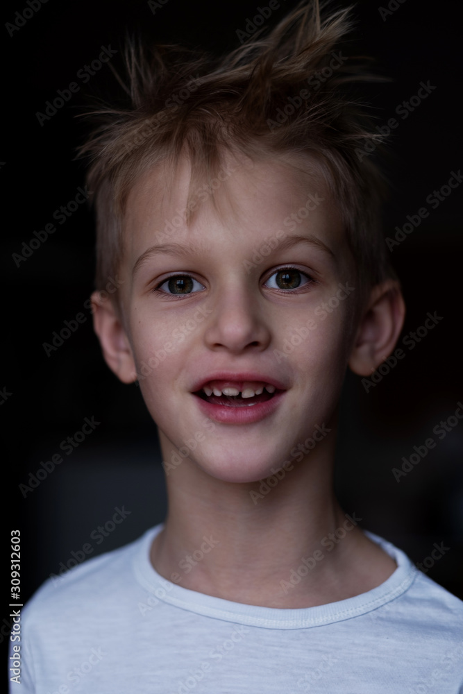 Portrait of a charming boy with changing teeth Portrait of a charming boy with changing teeth