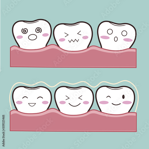Vector illustration of a Silicon exerciser for the teeth. Invisible braces on cartoon teeth.  Characters can be used to advertise a transparent bracket in a dental clinic.