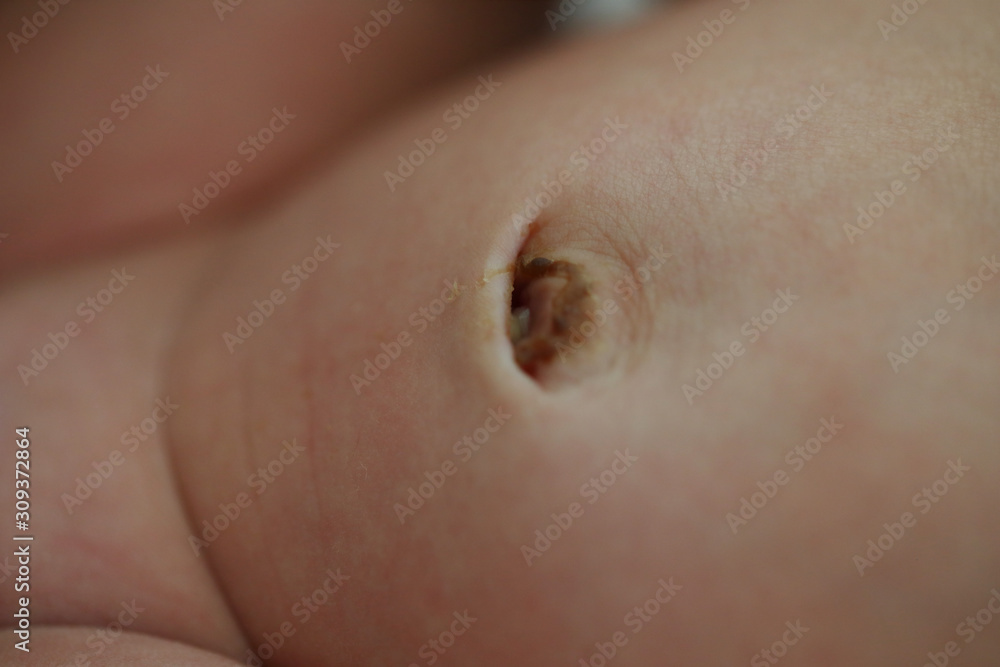 navel of newborn baby, closeup image navel of newborn baby, closeup image