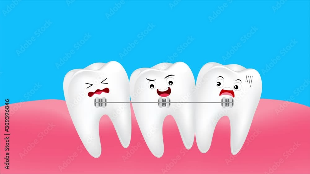 Cute cartoon teeth braces. Dental care concept, animation. Cute cartoon teeth braces. Dental care concept, animation.