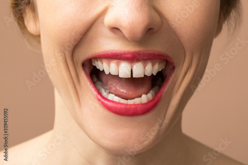 Unrecognisable Woman Laughing