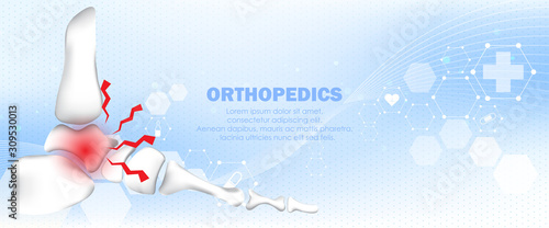 Medical orthopedic and the future of the smart hospital. Treatment for orthopedics traumatology of foot, ankle bones and joints injury. Medical presentation, hospital. Vector illustration