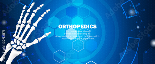 Medical orthopedic and the future of the smart hospital. Treatment for orthopedics traumatology of hand, wrist bones and joints injury. Medical presentation, hospital. Vector illustration