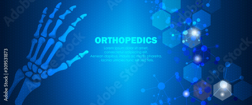 Medical orthopedic and the future of the smart hospital. Treatment for orthopedics traumatology of hand, wrist bones and joints injury. Medical presentation, hospital. Vector illustration