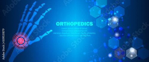 Medical orthopedic and the future of the smart hospital. Treatment for orthopedics traumatology of hand, wrist bones and joints injury. Medical presentation, hospital. Vector illustration