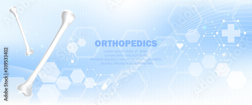 Medical orthopedic and the future of the smart hospital. Treatment for orthopedics traumatology of humerus bones and joints injury. Medical presentation, hospital. Vector illustration