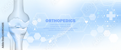 Medical orthopedic and the future of the smart hospital. Treatment for orthopedics traumatology of knee bones and joints injury. Medical presentation, hospital. Vector illustration