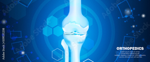 Medical orthopedic and the future of the smart hospital. Treatment for orthopedics traumatology of knee bones and joints injury. Medical presentation, hospital. Vector illustration
