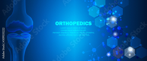 Medical orthopedic and the future of the smart hospital. Treatment for orthopedics traumatology of knee bones and joints injury. Medical presentation, hospital. Vector illustration photo