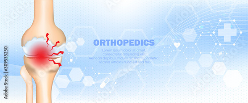 Medical orthopedic and the future of the smart hospital. Treatment for orthopedics traumatology of knee bones and joints injury. Medical presentation, hospital. Vector illustration
